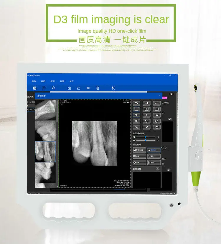 Портативный стоматологический рентгеновский аппарат Цифровая беспроводная система визуализации пленки с низким уровнем излучения HD сенсорный экран Портативное стоматологическое рентгеновское устройство3